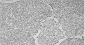 The microstructure of the welding seam of ASTM A335 P11 pipes.