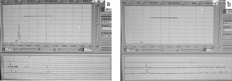 ultrasonic test results on titanium tubes (screenshot)